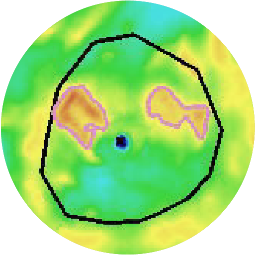 B1–2: Normal