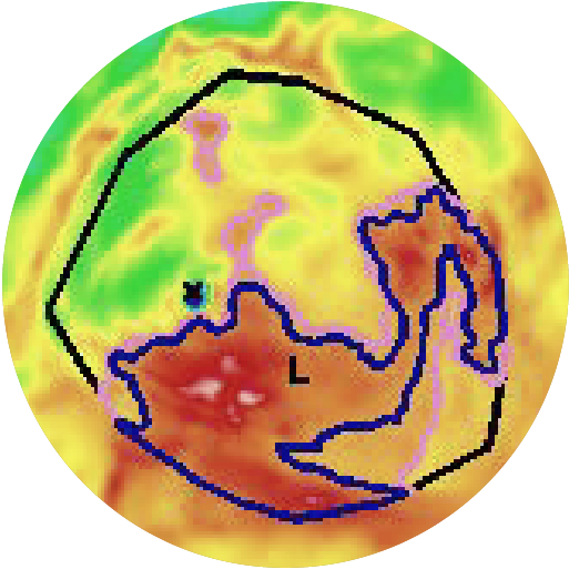 B4–5: Abnormal heat signals